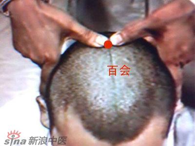 艾灸常用的保健穴有哪些？--百會
