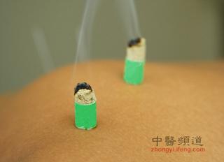 點(diǎn)擊將在新窗口查看全圖 中醫(yī)艾灸養(yǎng)生的十大禁忌