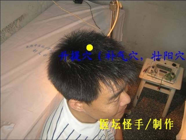 點(diǎn)擊將在新窗口查看全圖 王文遠(yuǎn)平衡針灸穴位圖 - 3396815 - 3396815博愛