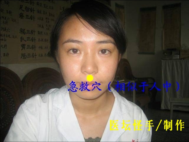 點(diǎn)擊將在新窗口查看全圖 王文遠(yuǎn)平衡針灸穴位圖 - 3396815 - 3396815博愛