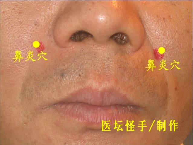 點(diǎn)擊將在新窗口查看全圖 王文遠(yuǎn)平衡針灸穴位圖 - 3396815 - 3396815博愛