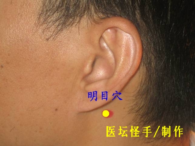 點(diǎn)擊將在新窗口查看全圖 王文遠(yuǎn)平衡針灸穴位圖 - 3396815 - 3396815博愛
