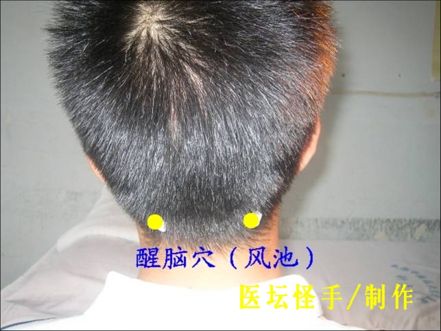 點(diǎn)擊將在新窗口查看全圖 王文遠(yuǎn)平衡針灸穴位圖 - 3396815 - 3396815博愛